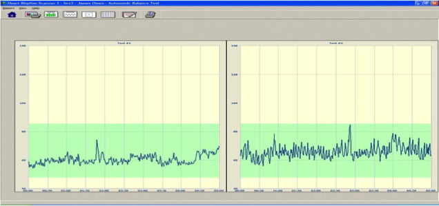 リアルタイムモニタリングスクリーン(心拍グラフ報告書)