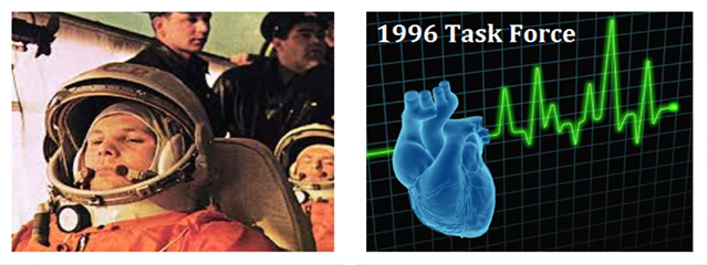 HRVの歴史的概略イメージ写真