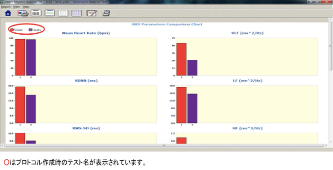 心拍変動指標比較グラフ