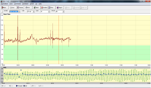 Edit raw data(データ編集)