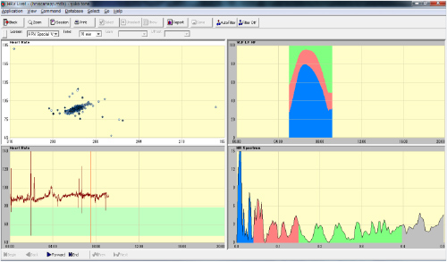 HRV　Special View (心拍変動スペシャル)
