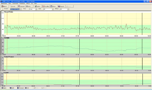 View HRV Graphs(心拍変動グラフ観察)