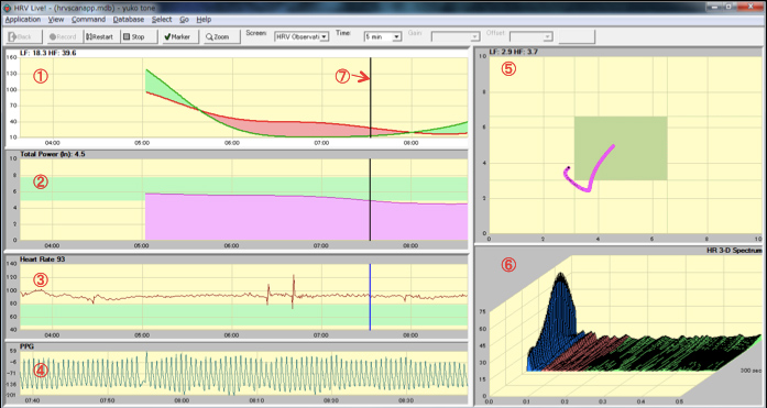 ＨＲＶ ＬＩＶＥ計測画面（心拍変動観察）